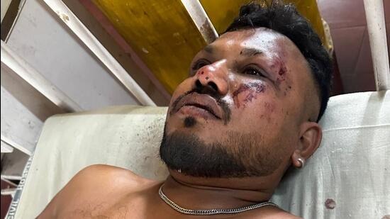 AI-171 Crash: One Man Lived Through It, One Woman Missed It